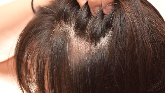 抜け毛 細毛にも効果大 白ごま油 を使った頭皮マッサージ Antenna アンテナ