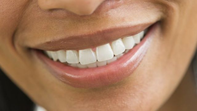 Tiktokで流行中の 爪やすりで歯を整える 動画に歯科医が警鐘 Antenna アンテナ
