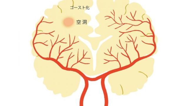 耳たぶのシワ で動脈硬化をチェック 病気予防に役立つ不調のサイン Antenna アンテナ