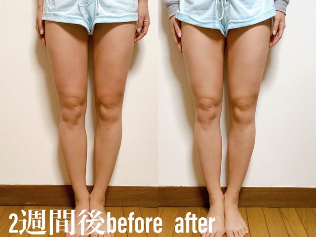10kg痩せたけど 脚だけは細くならなかった そんな私が挑む 筋膜リリース2週間チャレンジ Antenna アンテナ