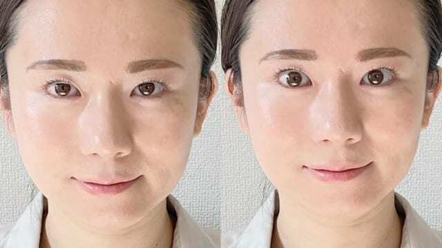 きれいなおでこ を作る簡単ケア 気になるでこぼこ 厚みを改善 Antenna アンテナ