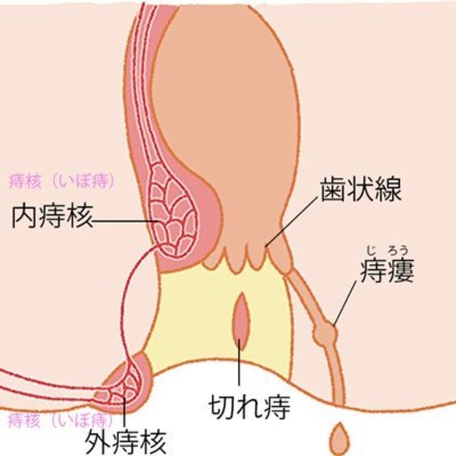 排便時に痛むのは痔のサイン 専門家医が答える女性の体悩みq A Antenna アンテナ