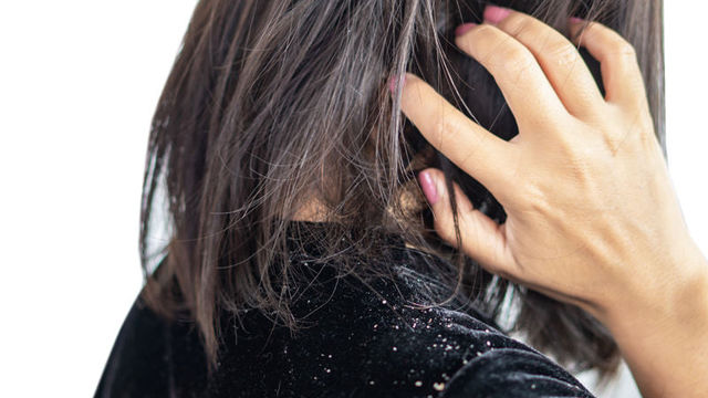 人前でも無意識に触ってしまう 頭皮のかさぶたを剥がす癖をやめたい お悩み相談 Antenna アンテナ