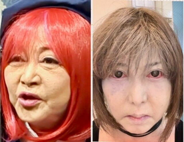 うつ状態の引きこもり生活”を経て…65歳の作家・中村うさぎが再び美容 
