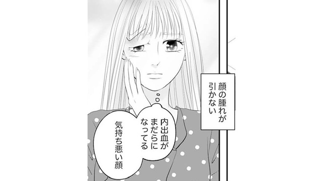 顔だけが取り柄の私なのに腫れが引かない。これからどうすればいいの？【かつて女の子だった人たちへ #32】 | antenna[アンテナ]