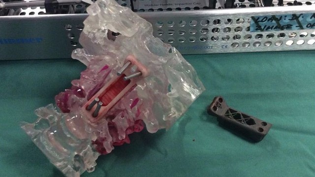 左耳を失った米女性兵士 前腕で育てた耳の移植手術に成功 Antenna アンテナ