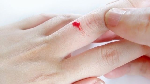 生理中にうっかり 下着や服についた 血液のシミ を落とす方法 Antenna アンテナ