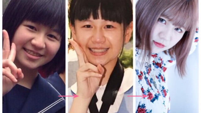 外見至上主義となったタレント入澤優さん 前編 私が整形した理由 第4回 連載 Antenna アンテナ