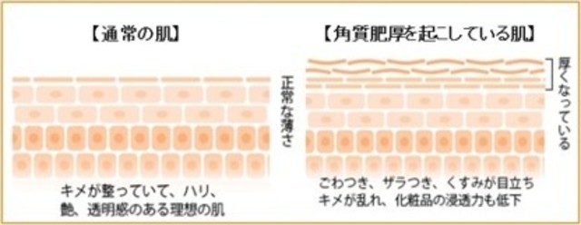 full db6120b9 35a0 4b45 980a 8bc4c94e1dfe